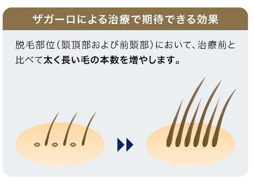 ザガーロのはたらき